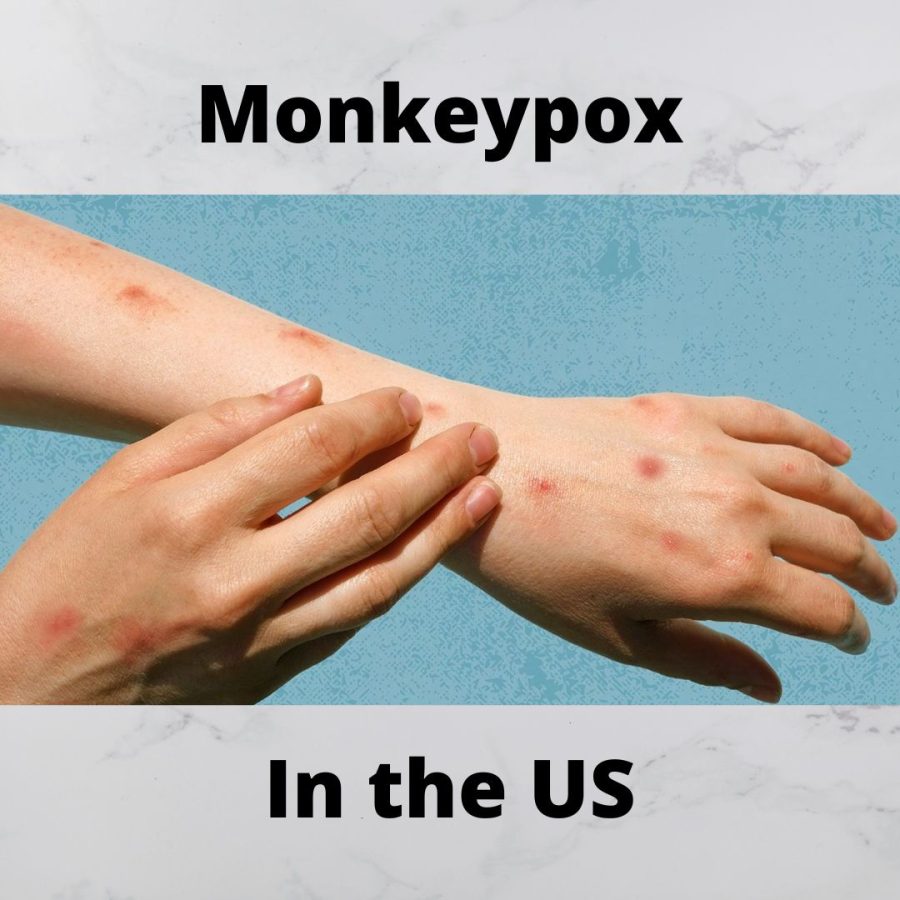 The results of Monkeypox