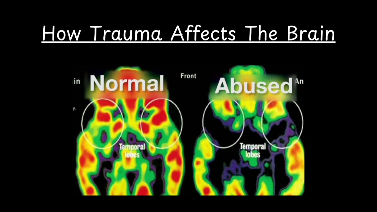 How Trauma Effects tThe Brainh